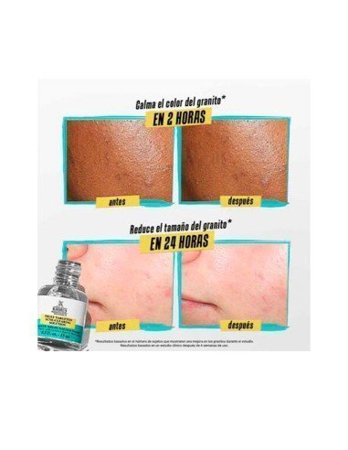 Acheter Kiehl's Truly Targeted Solution - Liquid Acne Patch | Sam Parfums