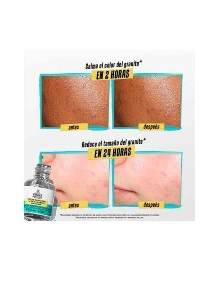 Acheter Kiehl's Truly Targeted Solution - Liquid Acne Patch | Sam Parfums