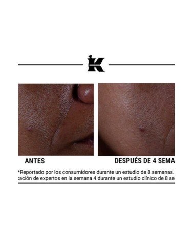 Kiehl's Ultra Pure Glycolic Acid Serum - Exfoliation & Renewal | Sam Parfums kaufen