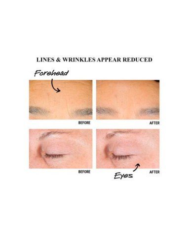 Acheter Kiehl's Retinol Skin-Renewing Daily Micro-Dose Serum - Anti-Aging Face Serum | Sam Parfums