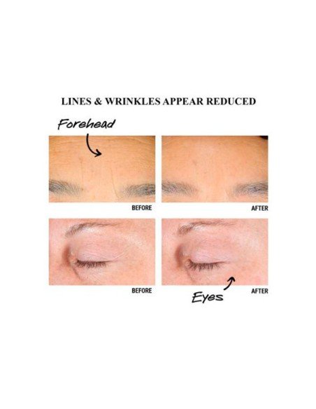 Acquista Kiehl's Retinol Skin-Renewing Daily Micro-Dose Serum - Siero viso anti-età | Sam Parfums
