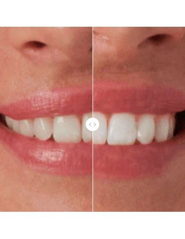 UNICLED WHITE SMILE da Unicskin | Branqueamento eficaz dos dentes com luz LED