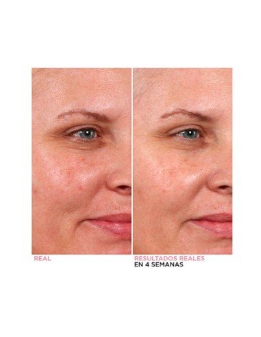 IT Biphasic Peel : exfoliation et nutrition quotidiennes pour une peau radieuse