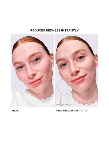 Bye Bye Redness Serum: lenisce la pelle sensibile e riduce istantaneamente i rossori con efficacia clinica