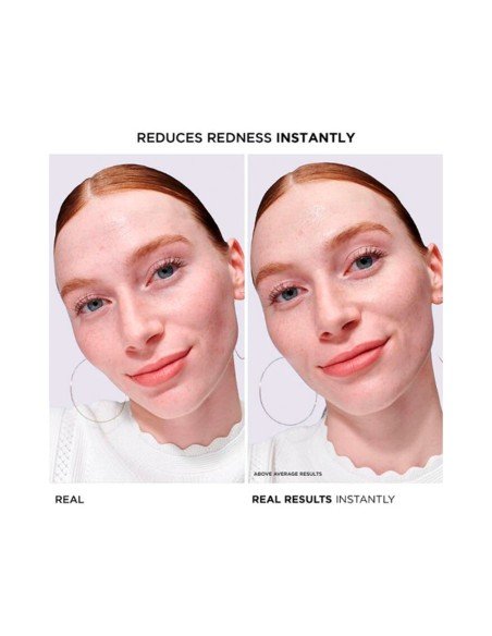 Sérum Bye Bye Redness: calma piel sensible y reduce rojez al instante con eficacia clínica