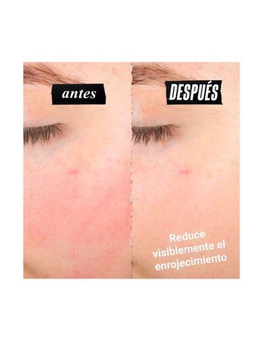 Kiehl's Gesichtscreme: Reparatur für empfindliche und gereizte Haut, sofortiger Komfort und Linderung