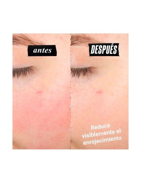 Kiehl's Gesichtscreme: Reparatur für empfindliche und gereizte Haut, sofortiger Komfort und Linderung